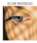 Scar Revision
